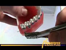 Wires For Marble-Dry Cutting